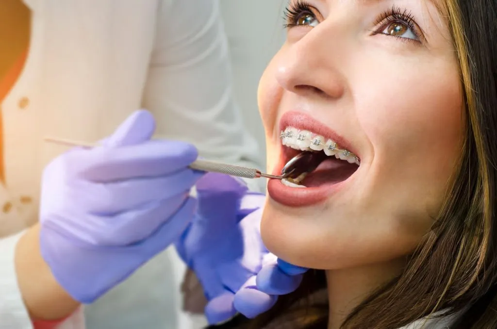 Orthodontics treatment at Tulip Dental Maplewood
