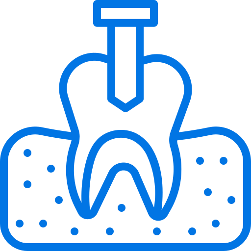 Dental Implant