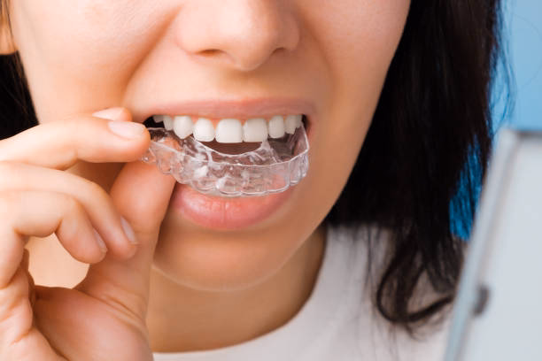 Invisalign at Tulip Dental Irvington
