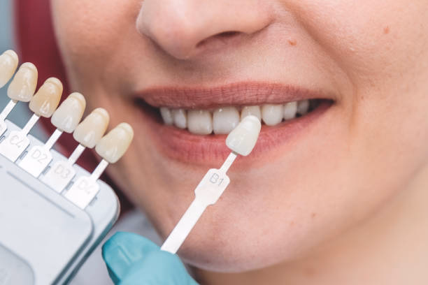 Permanent Teeth Replacement at Tulip Dental Irvington