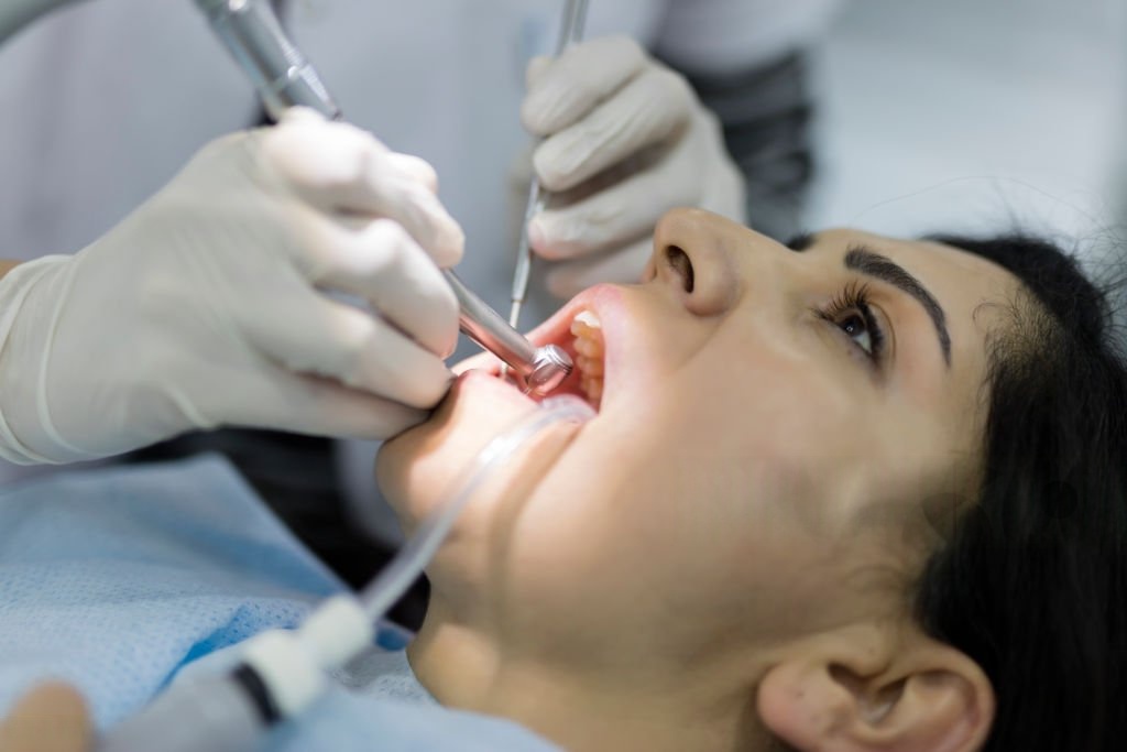 Root Canal